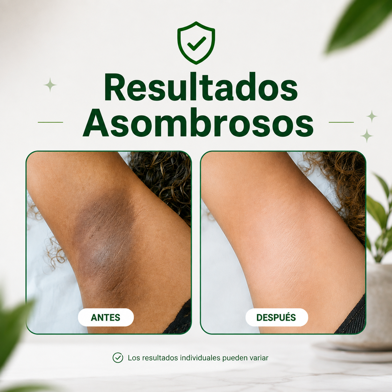 Yuyi  |  Parches despigmentantes y aclarantes