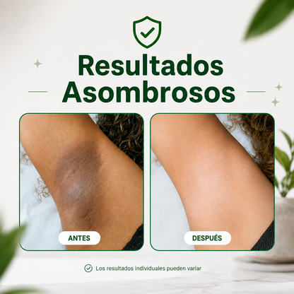 Yuyi  |  Parches despigmentantes y aclarantes