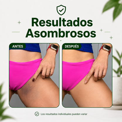 Yuyi  |  Parches despigmentantes y aclarantes